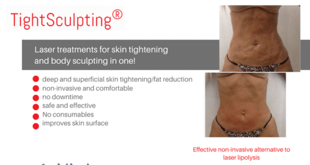 Tightsculpting package - Medium Size area Buy 2, get 1 FREE (Save: $400)